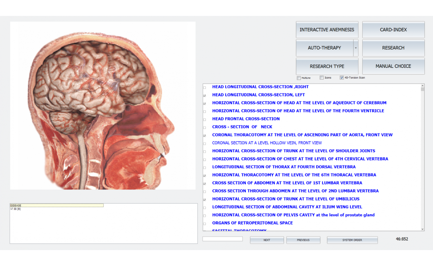 We Should Pay More Attention On NLS Diagnosis And NLS-diagnostic Equipment