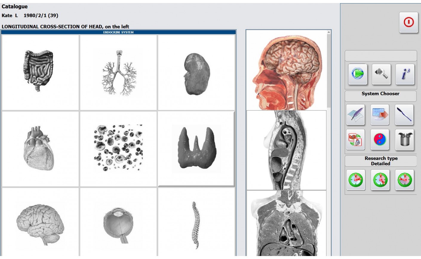 Research With Metatron Hunter Can Detect The Nasopharynx Tumor