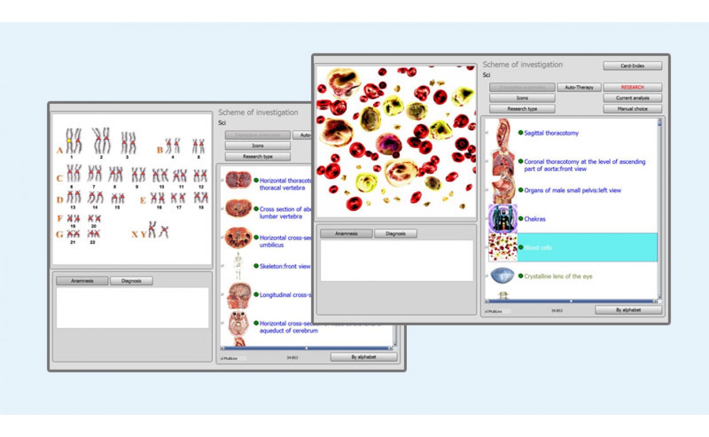 Virtual NLS-graphy Through 9D NLS For Colon Cancer