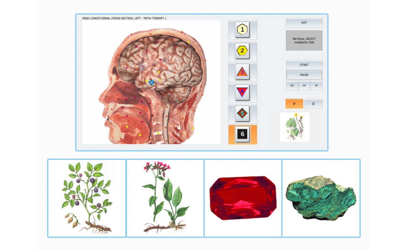 The Application Of The NLS- technologies With Biophilia NLS In Diagnosis Of AP